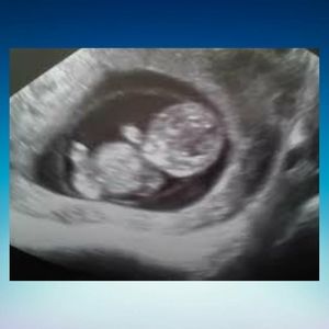 Meet your Posher, Alvin